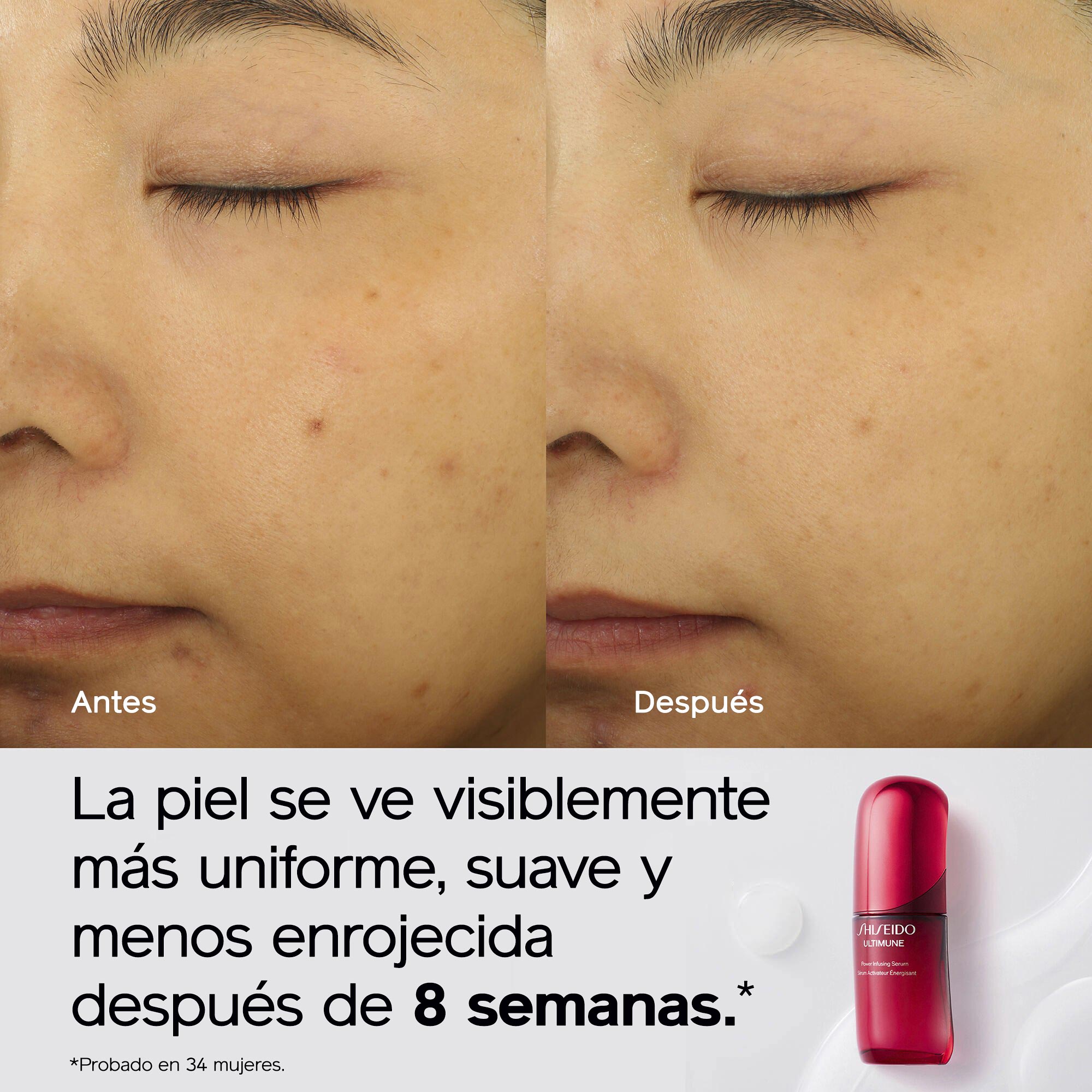 Imágenes del antes y el después del rostro de una persona, en las que se aprecia una piel visiblemente más uniforme, suave y con menos rojeces tras 8 semanas. También se muestra un envase rojo de Shiseido UltiMune Serum.