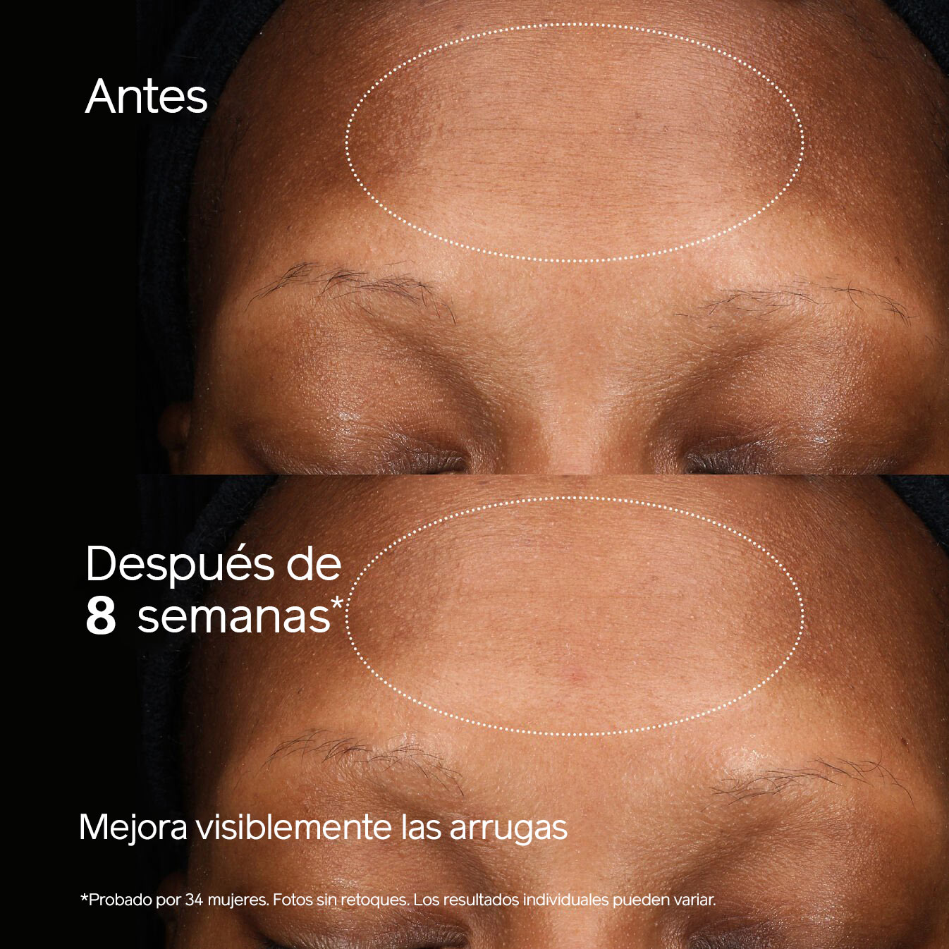 Total Regenerating Cream,