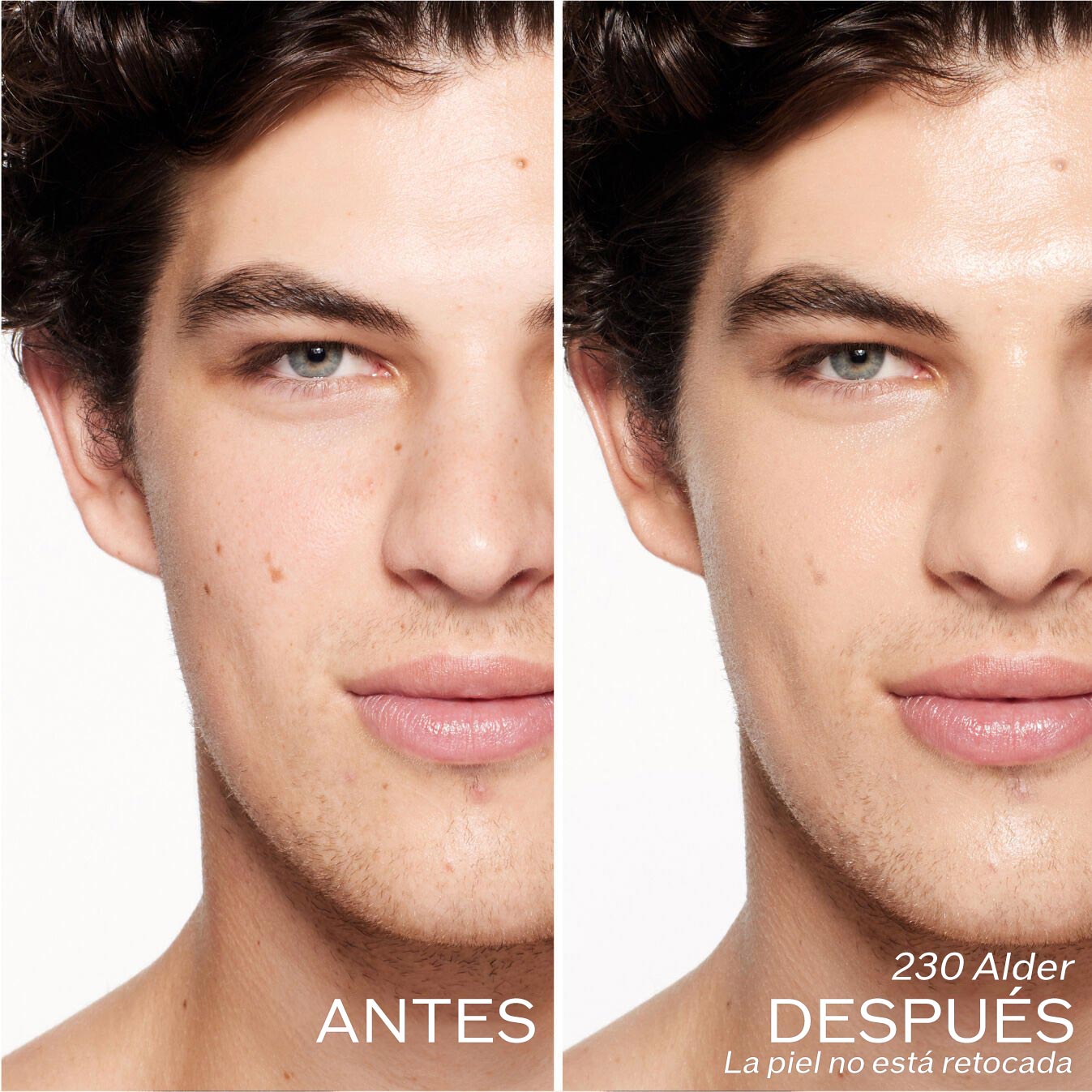 Dos fotografías de una modelo. La primera imagen es una foto del rostro antes y la segunda después de aplicar 230 Alder. La piel no está retocada.