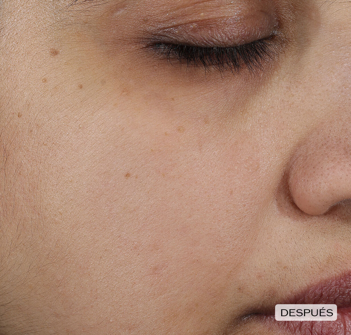 Brightening and Wrinkle Smoothing Cream,