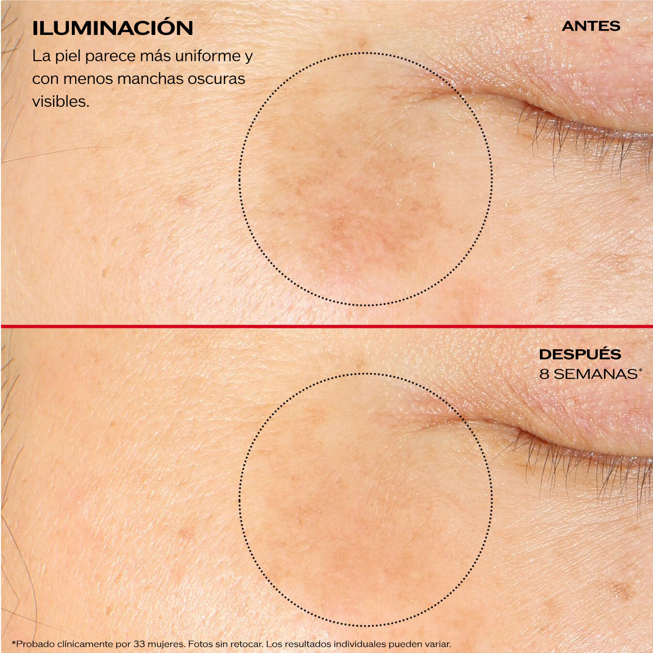 Una comparación con una pantalla dividida con el título "Iluminar" en la que se observa un primer plano de la piel de una mejilla. Imagen superior con el rótulo "Antes", destaca las manchas oscuras visibles dentro de un círculo punteado. En la imagen inferior con el rótulo "Después de 8 semanas", se observa la misma área con las manchas oscuras que disminuyeron notablemente, lo que demuestra una piel con un tono más parejo.