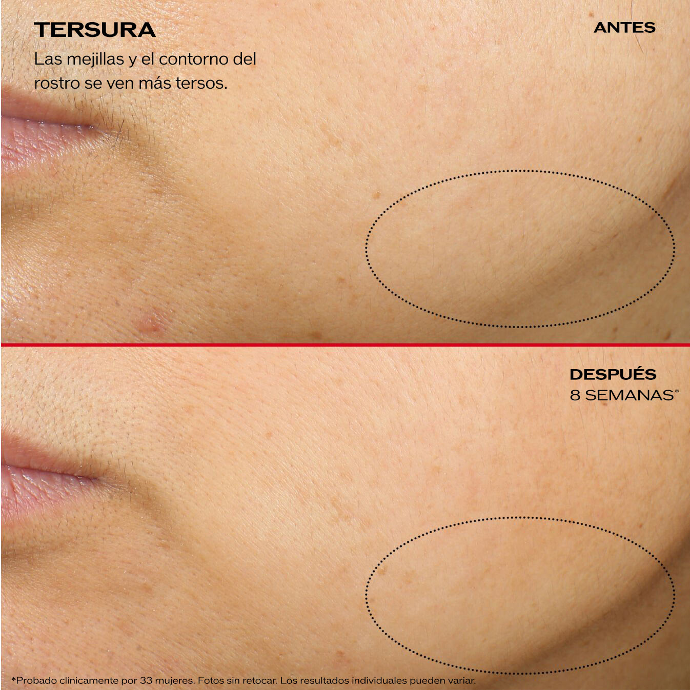 La comparación con la pantalla dividida muestra un primer plano de la mejilla y submaxilar de una persona. La imagen superior tiene el rótulo "Antes" con un círculo punteado en el que se destaca el contorno del mentón. La imagen inferior tiene el rótulo "Después de 8 semanas", donde se observa la misma área del círculo donde se observa mayor firmeza y suavidad. En el texto se observa: "Tersura: las mejillas y el contorno del rostro se ven más tersos".