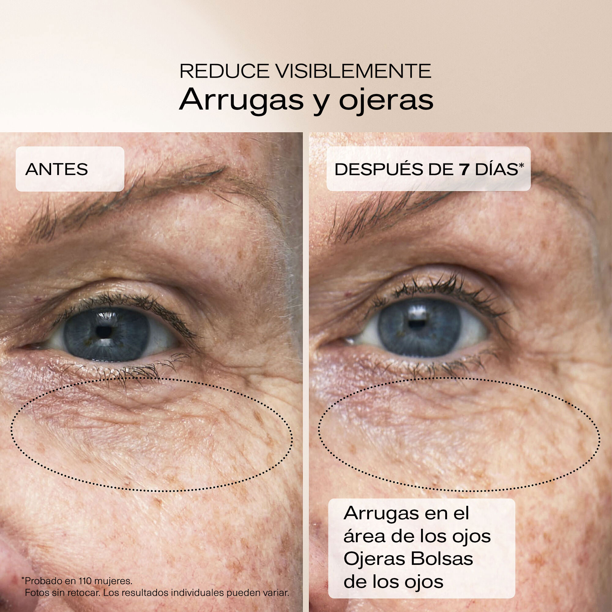 Wrinkle Smoothing Eye Cream,